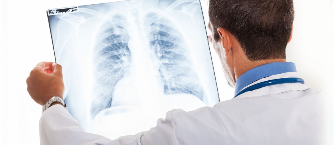exploring the link between low vitamin d and lung disease 3