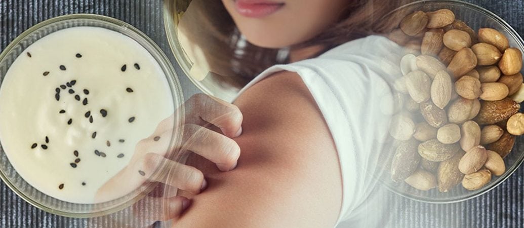using probiotics for eczema can help heal your skin 3