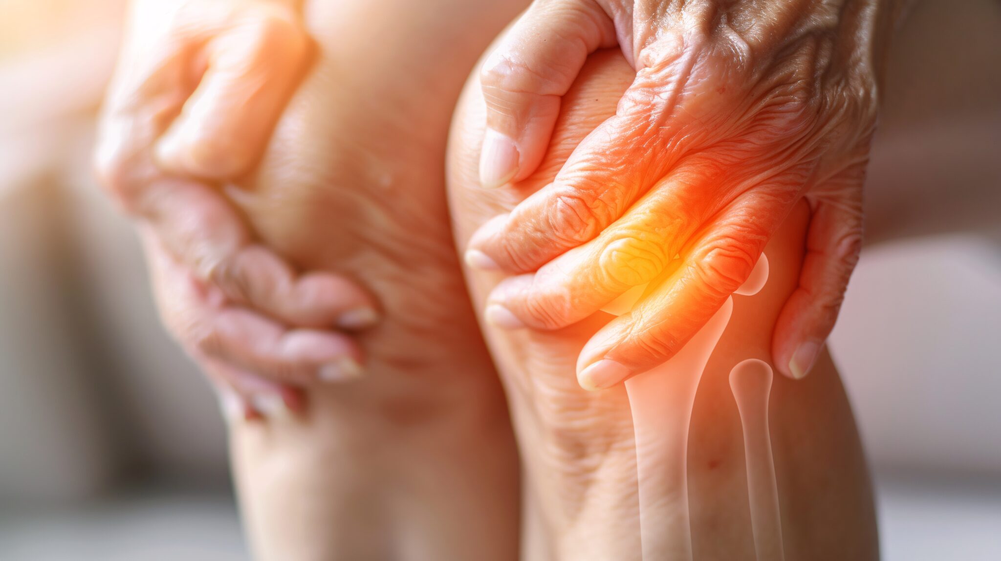Arthrose: Epilepsie-Medikament könnte Knorpel schützen und Gelenkschmerzen lindern