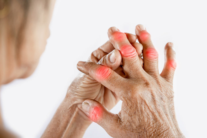 Comment retarder ou même prévenir la polyarthrite rhumatoïde