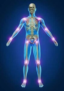 Rheumatoid Arthritis and Low Libido: The Effects of Joint Pain on Your Sex Life