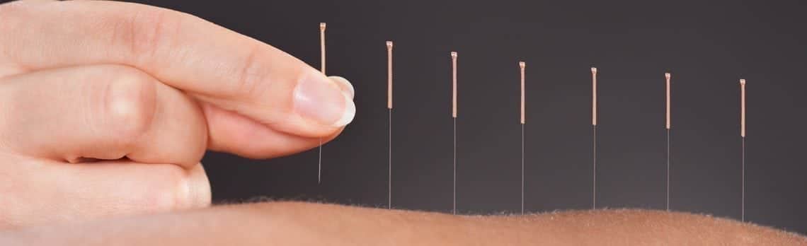 Akupunktur gegen eine schwache Libido und sexuelle Dysfunktion